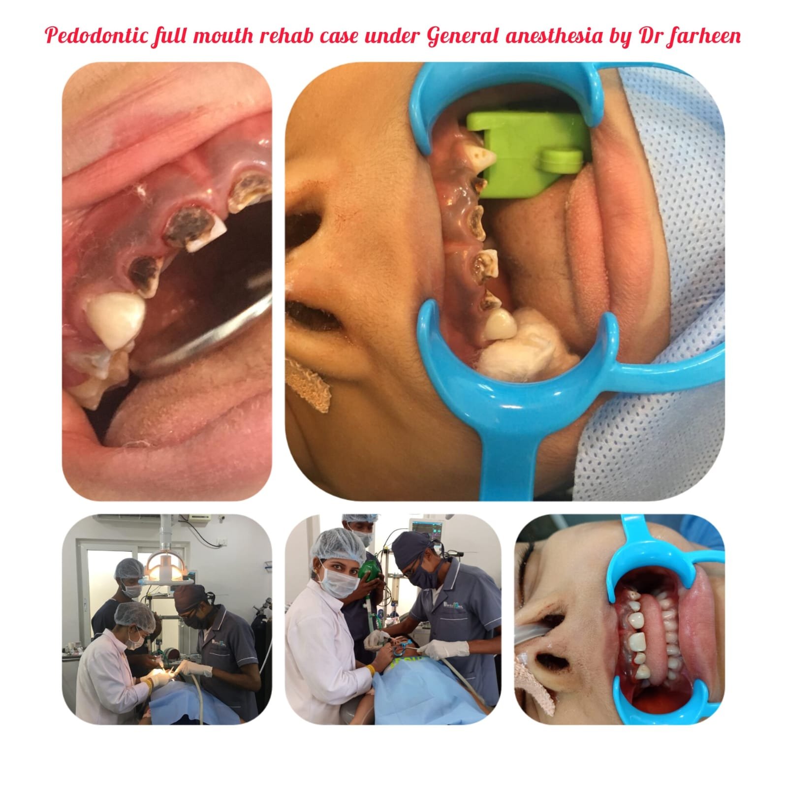 Best pediatric dental clinic in Hyderabad