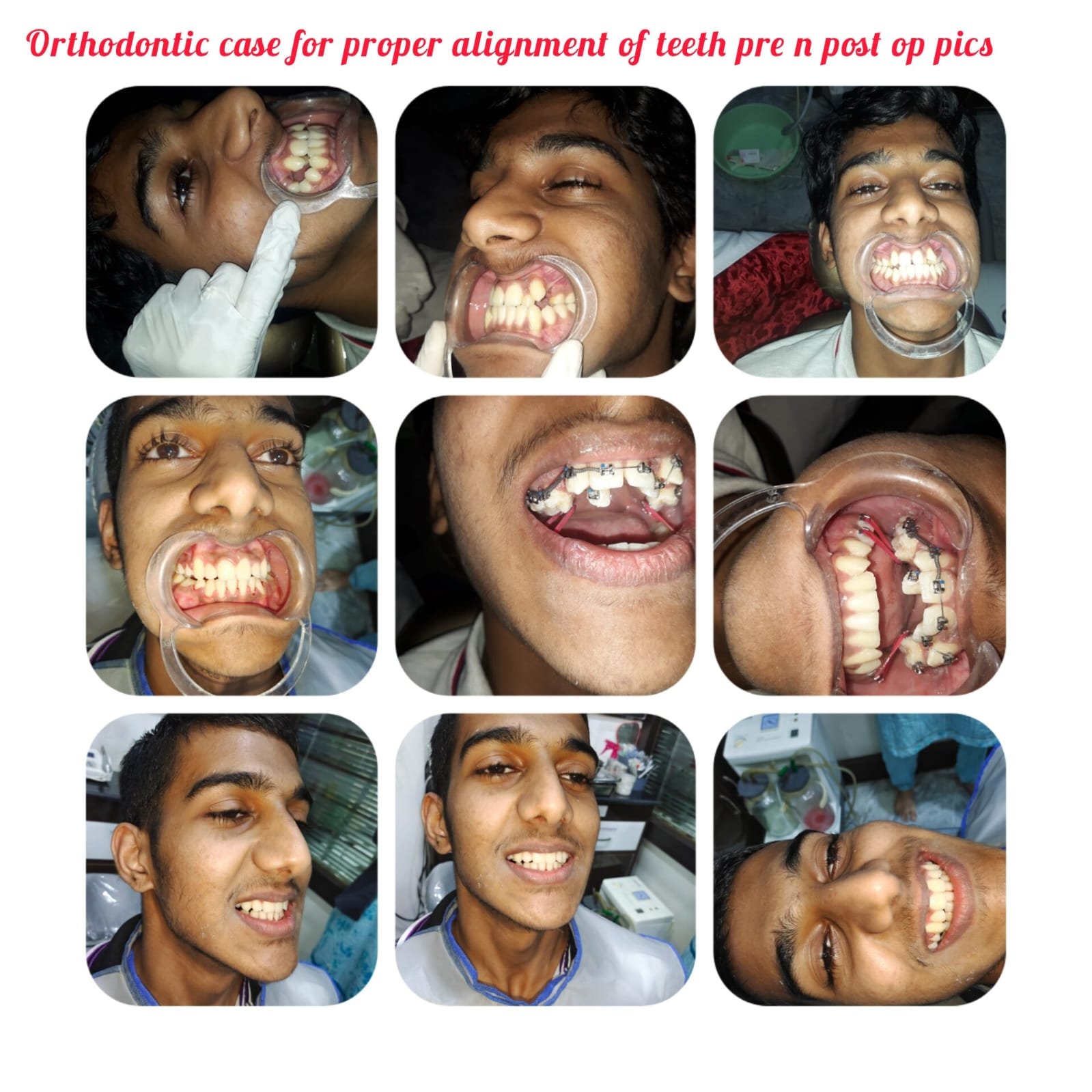 Best pediatric dental clinic in Hyderabad